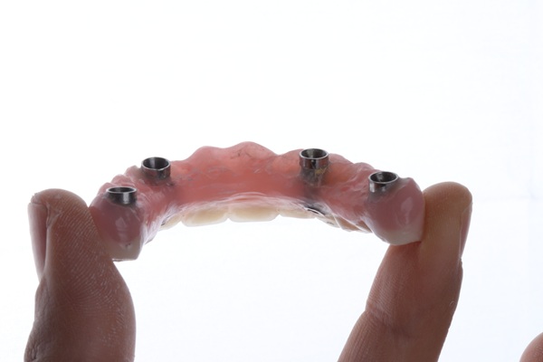 Smile Makeover Treatment: All On  ®