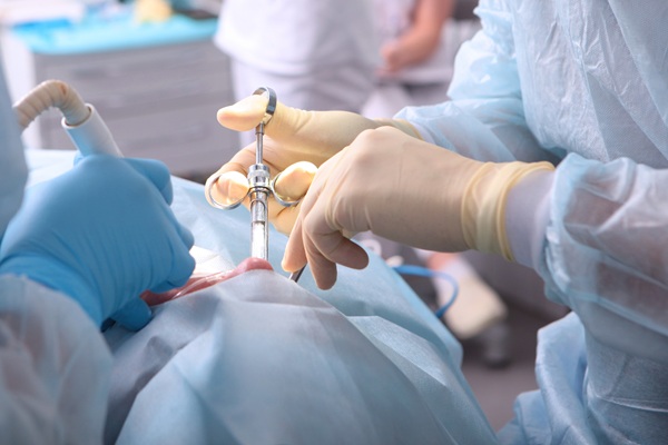 What Happens After Dental Implant Surgery?