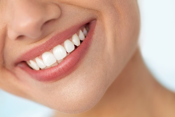 Caring For Your New Smile After A Smile Makeover